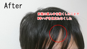 M字ハゲの前髪の割れ